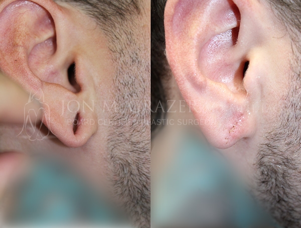 Before and After Image