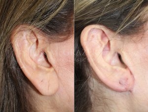 Before and After Image