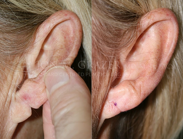 Before and After Image