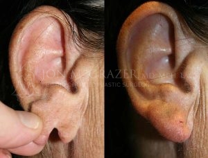 Before and After Image