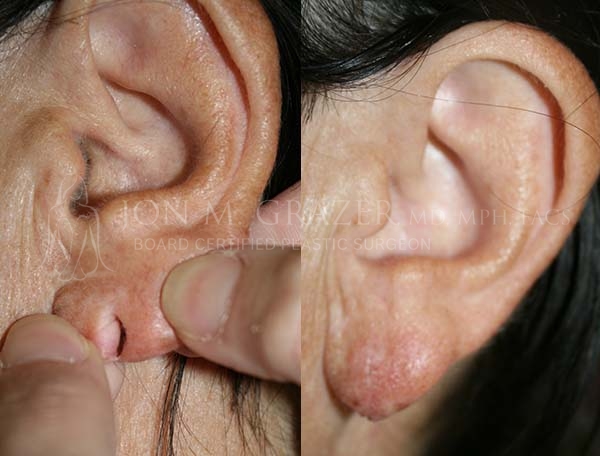 Before and After Image