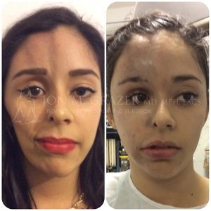 Before and After Image