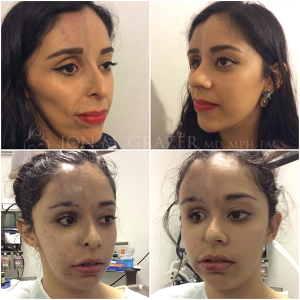 Before and After Image