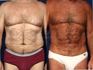 Before and After Image