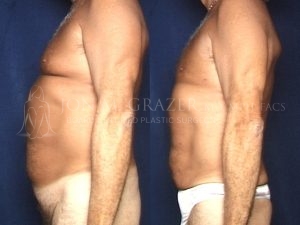 Before and After Image