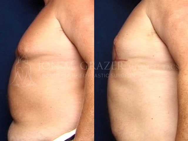 Before and After Image