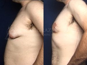 Before and After Image