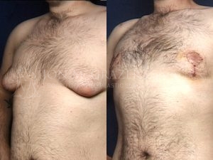 Before and After Image