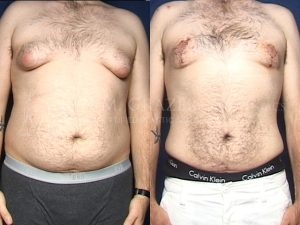 Before and After Image