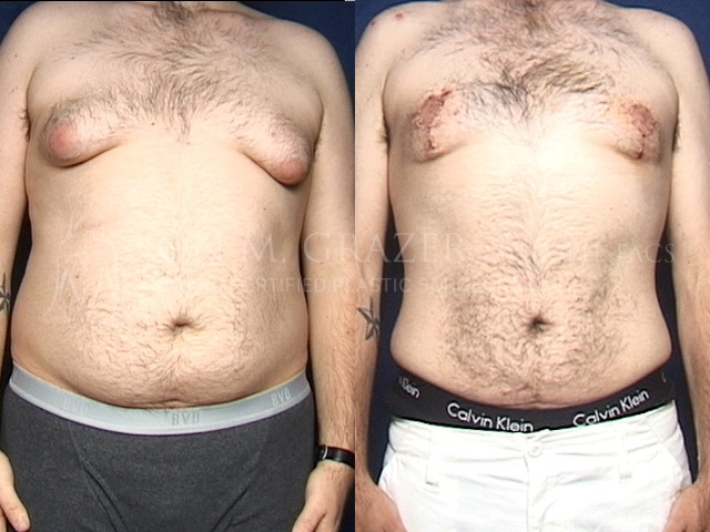 Before and After Image