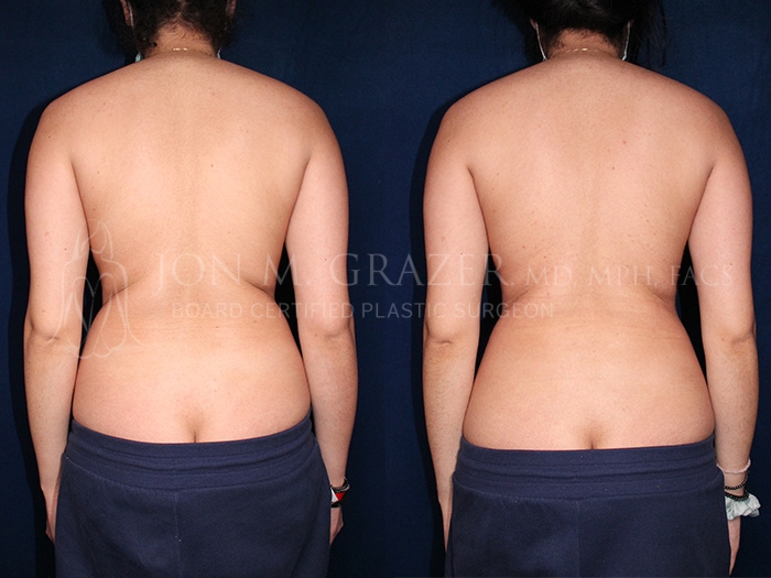 Before and After Image