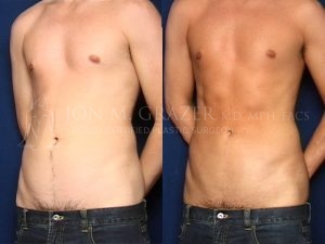 Before and After Image