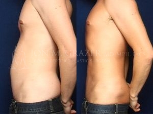 Before and After Image