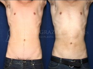 Before and After Image