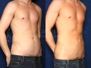 Before and After Image