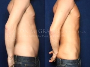 Before and After Image