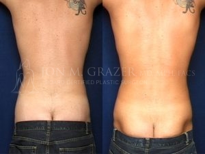 Before and After Image