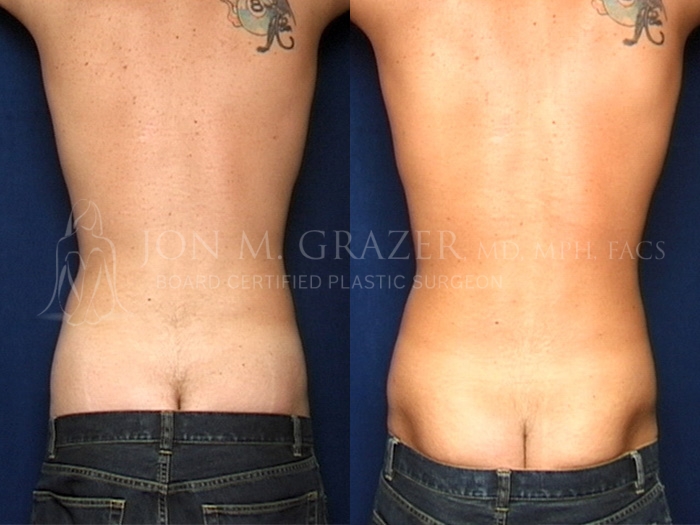 Before and After Image