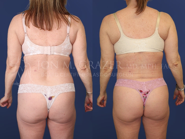 Before and After Image