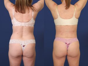 Before and After Image