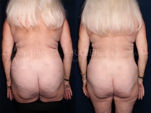 Before and After Image