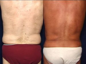 Before and After Image