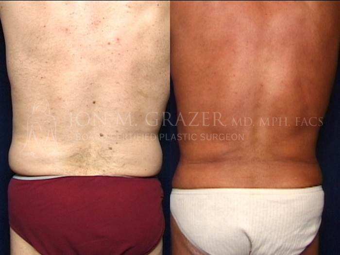 Before and After Image