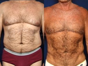 Before and After Image