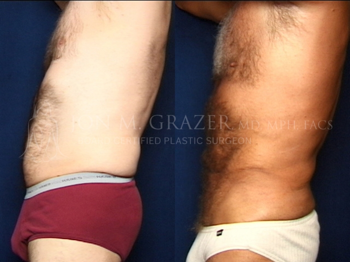 Before and After Image