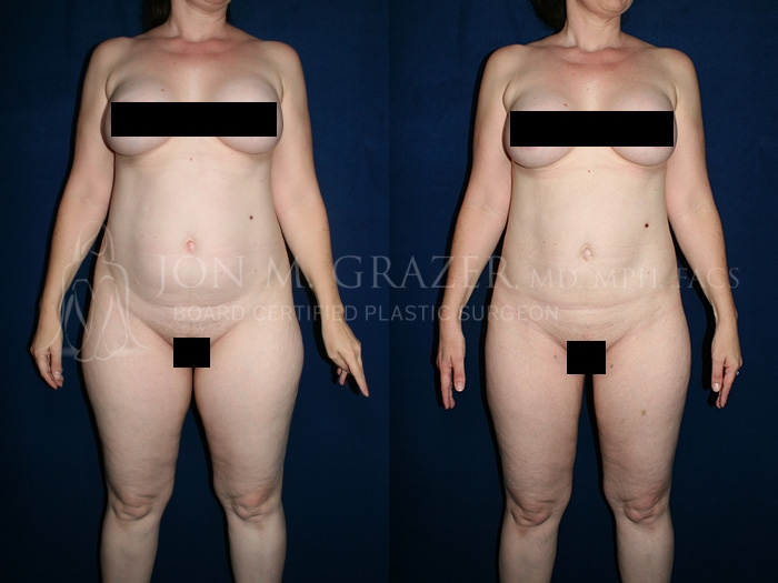 Before and After Image