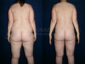 Before and After Image