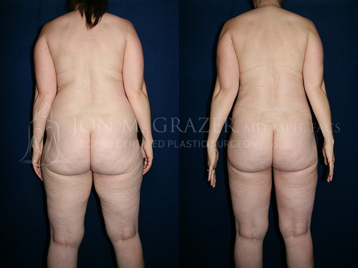 Before and After Image