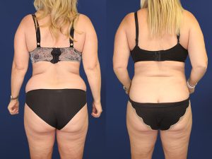 Before and After Image