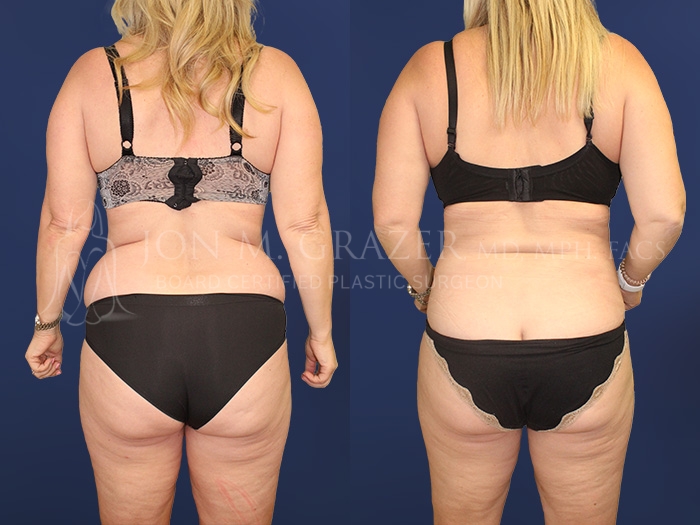 Before and After Image