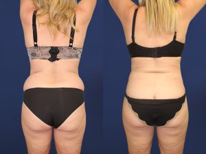 Before and After Image