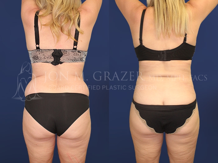 Before and After Image