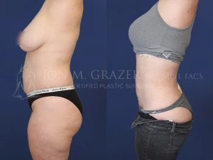 Before and After Image