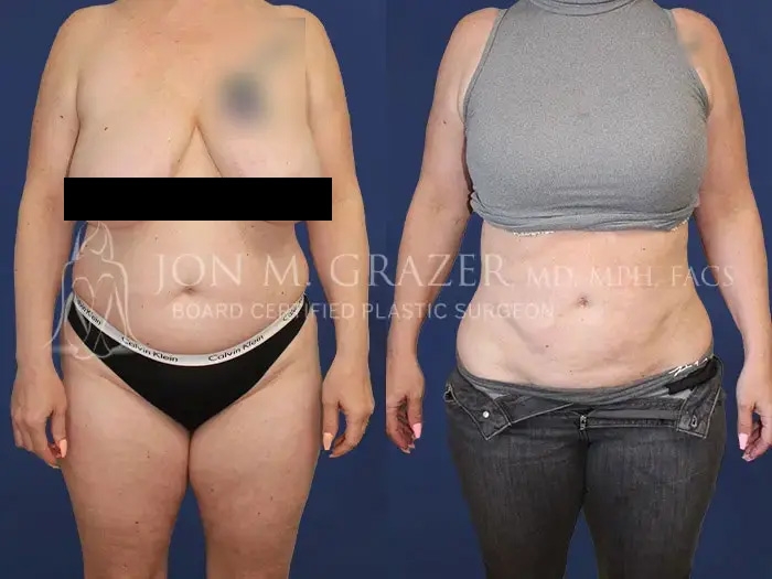 Before and After Image