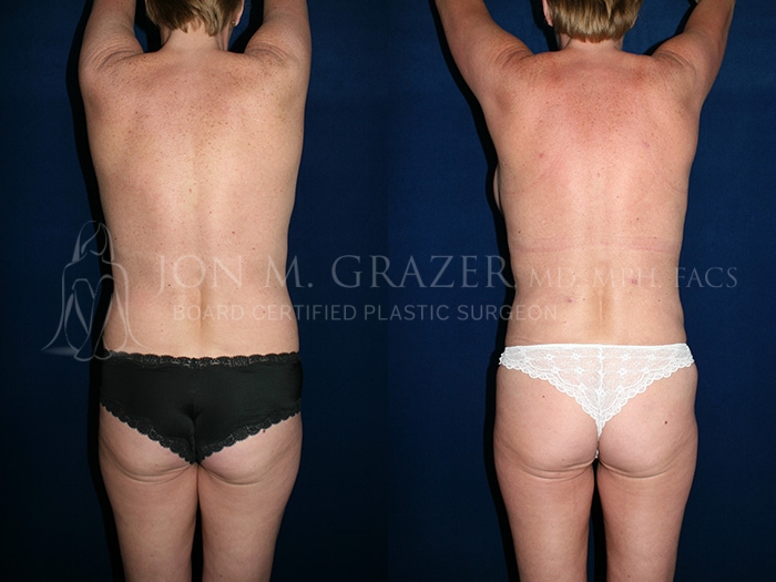 Before and After Image