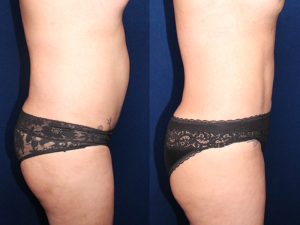 Before and After Image