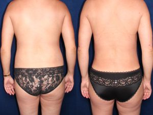 Before and After Image