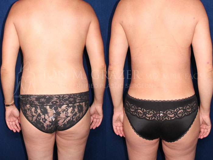 Before and After Image