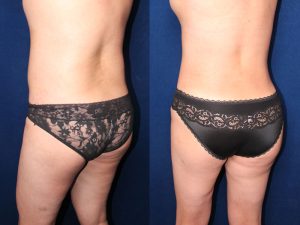 Before and After Image