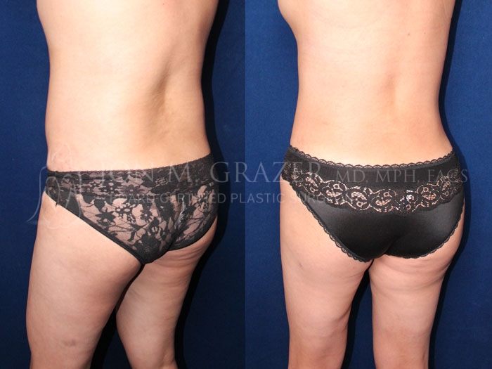 Before and After Image