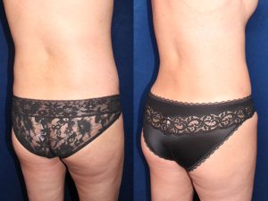 Before and After Image