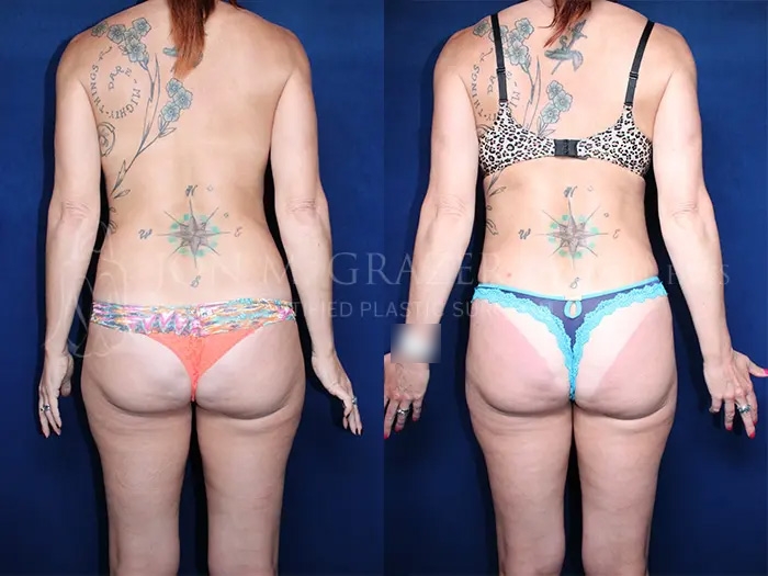 Before and After Image