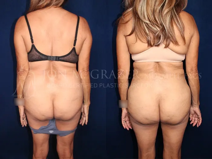 Before and After Image