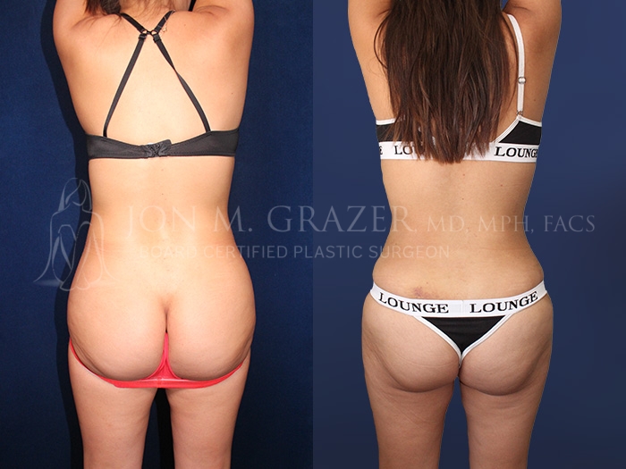 Before and After Image