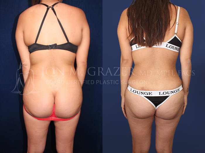 Before and After Image