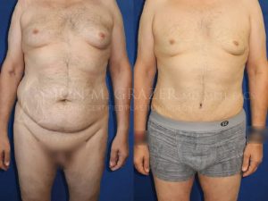 Before and After Image